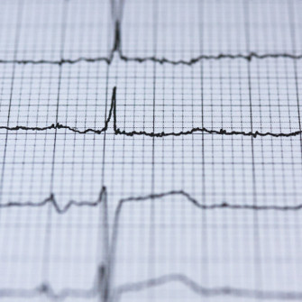 Variabilidad de la frecuencia cardíaca (VFC): la nueva medida del bienestar