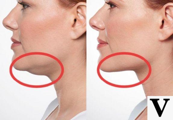 Eliminate Double Chin | Exercises That Can Help
