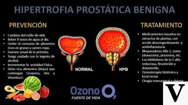 Dieta para la hipertrofia-hiperplasia prostática benigna