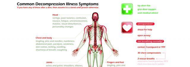 Symptômes Syndrome de décompression