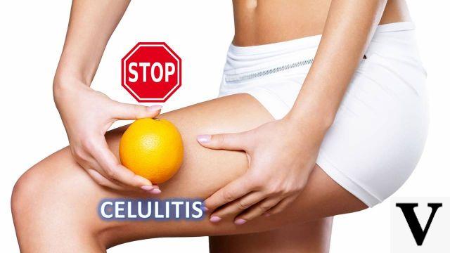 Nutrición y Celulitis