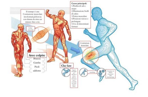 Calambres musculares | ¿Cuáles son? Causas y remedios