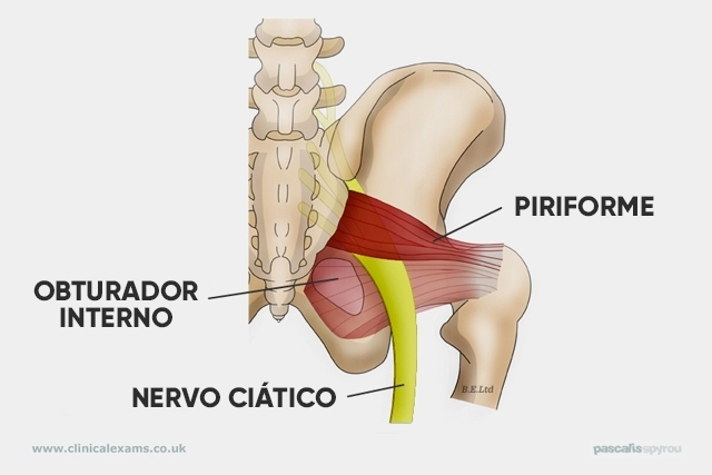Piriformis Muscle | Inflammation? Here's how to behave!