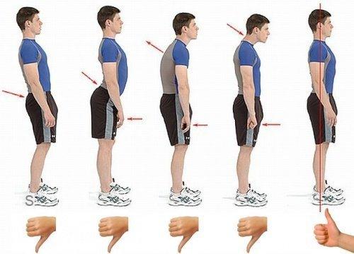 Arched Back: Exercises to Improve Spine Alignment